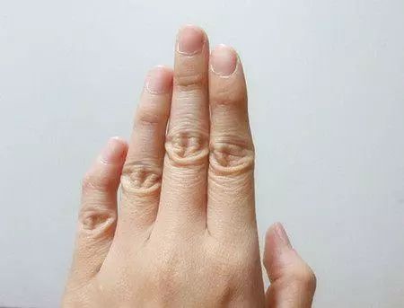 手指较短的人性格解析 　　一、无名指短的人个性沉稳