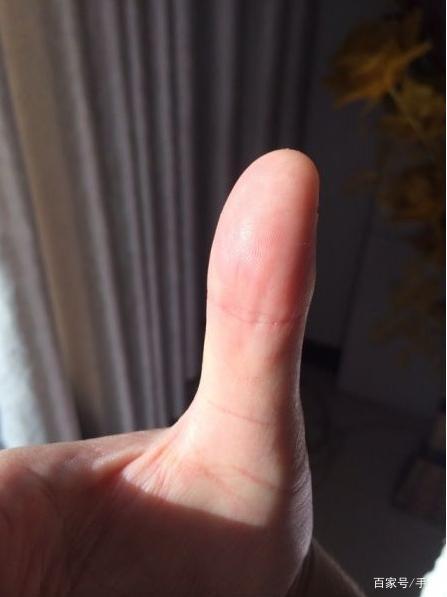 千年罕见的手相 大拇指下方出现0形纹路