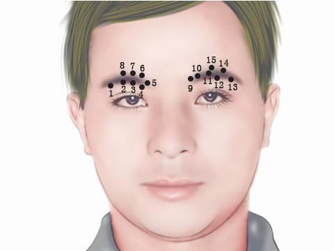 男性眉眼痣相图解 　　眉眼痣的象征含义：