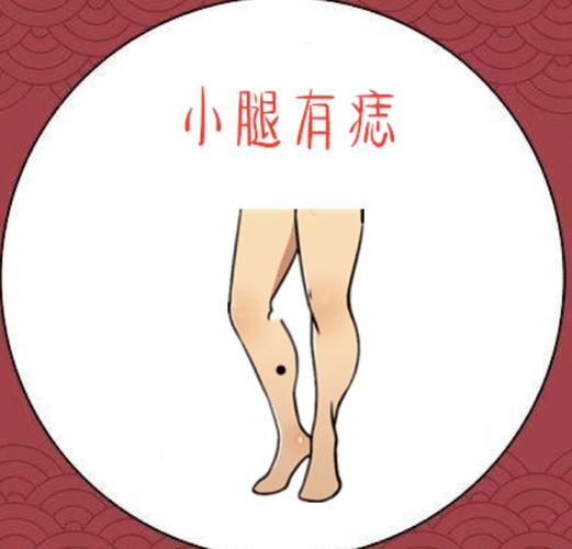 小腿有痣代表什么意思 一、小腿有痣代表的含义解析