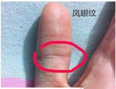伤痕对手相的影响有多大 拇指有伤痕的手相
