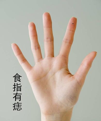 手指长痣有什么含义 食指长痣什么含义