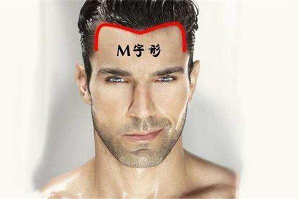 M字额的人多为男性 M字额的性格特点：