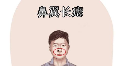 鼻翼右侧有痣代表什么 男人鼻翼右侧有痣有智慧