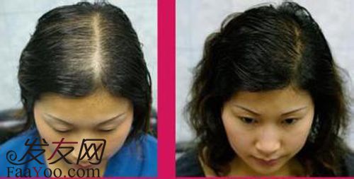 头发稀疏的女人运势解析 头发稀少的女人运势详解
