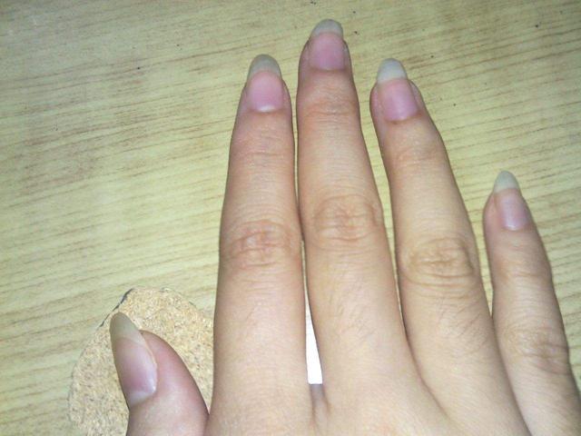 手指指甲较小的女人要注意哪些 　　一、营养方面
