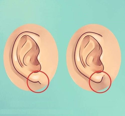 耳垂厚代表什么意思 一、耳朵耳垂厚的含义简析