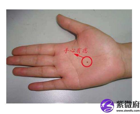 手掌心感情线上一颗痣代表什么 小指下方感情线有痣