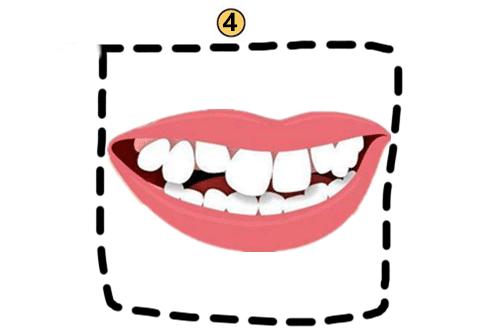 牙齿稀疏命运解析代表什么 牙齿稀疏的面相详解