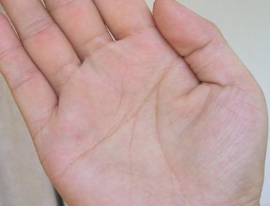 一只手两条断掌纹 断掌纹的常见的四种类型